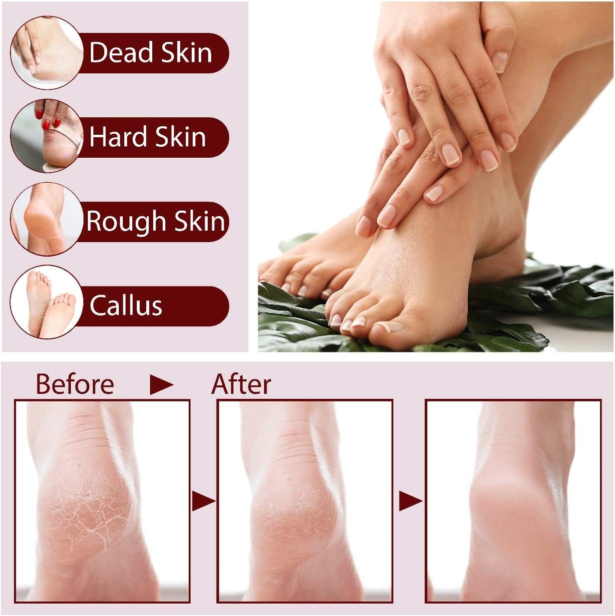 Electric Callus Remover vs. Manual Tools: Find Your Perfect Foot Care! feature image